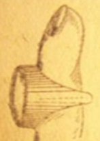 Плессиметр Гюгнеса (в виде перстня)