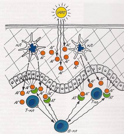 Схема аутоиммунных механизмов при ДКВ