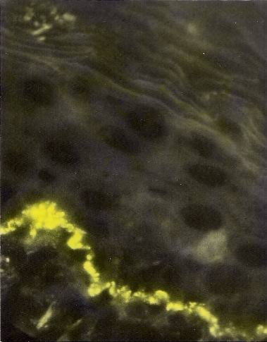 IgG на базальной мембране