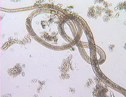 IПеченочный капилляриозmage037.jpg